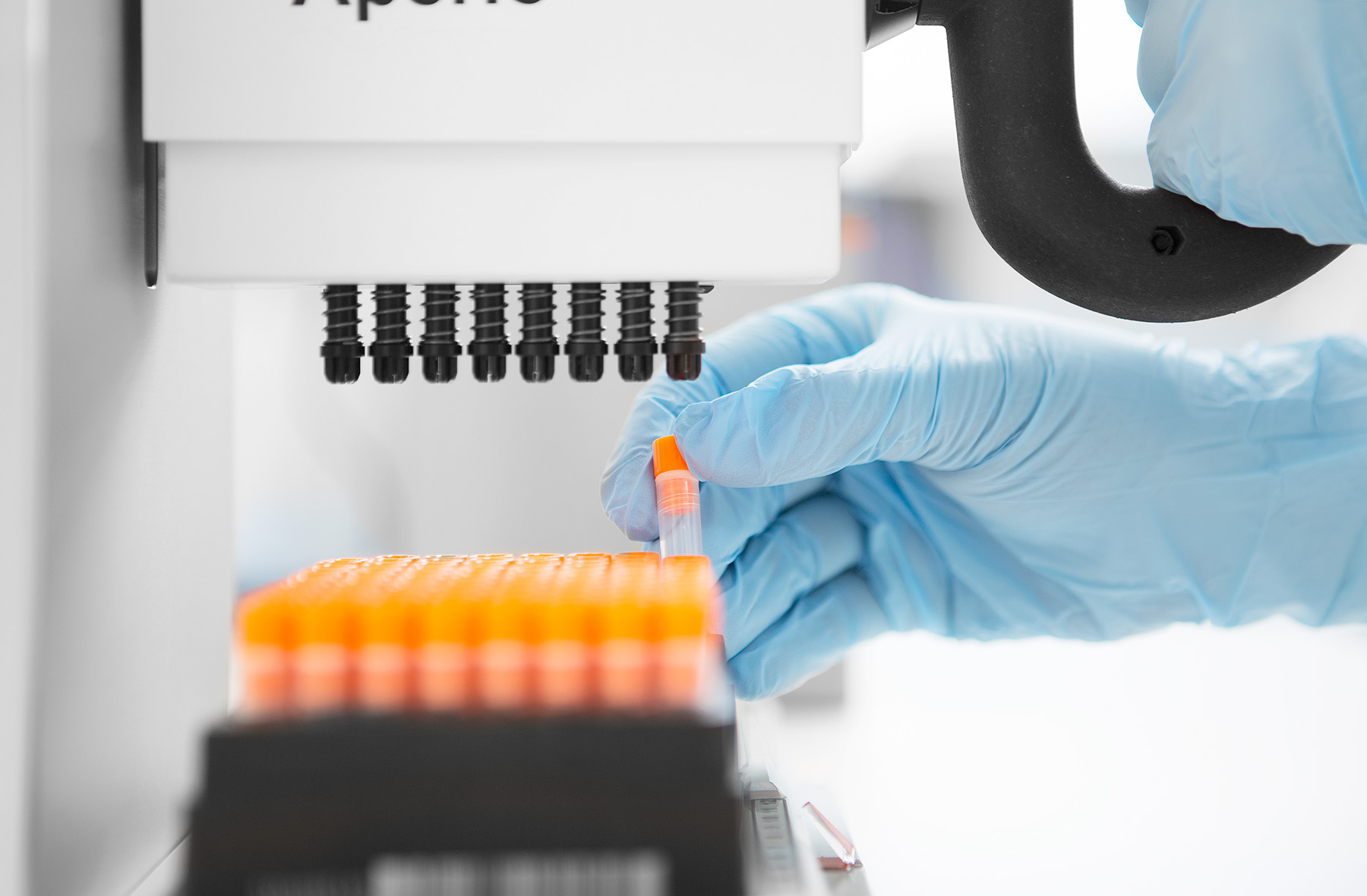 A research from biomarkers of pulmonary carcinoid tumors