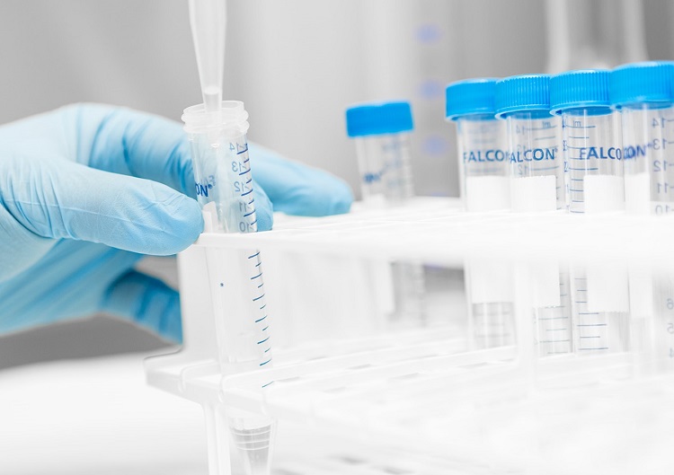 Itä-Suomen syöpäpäivä