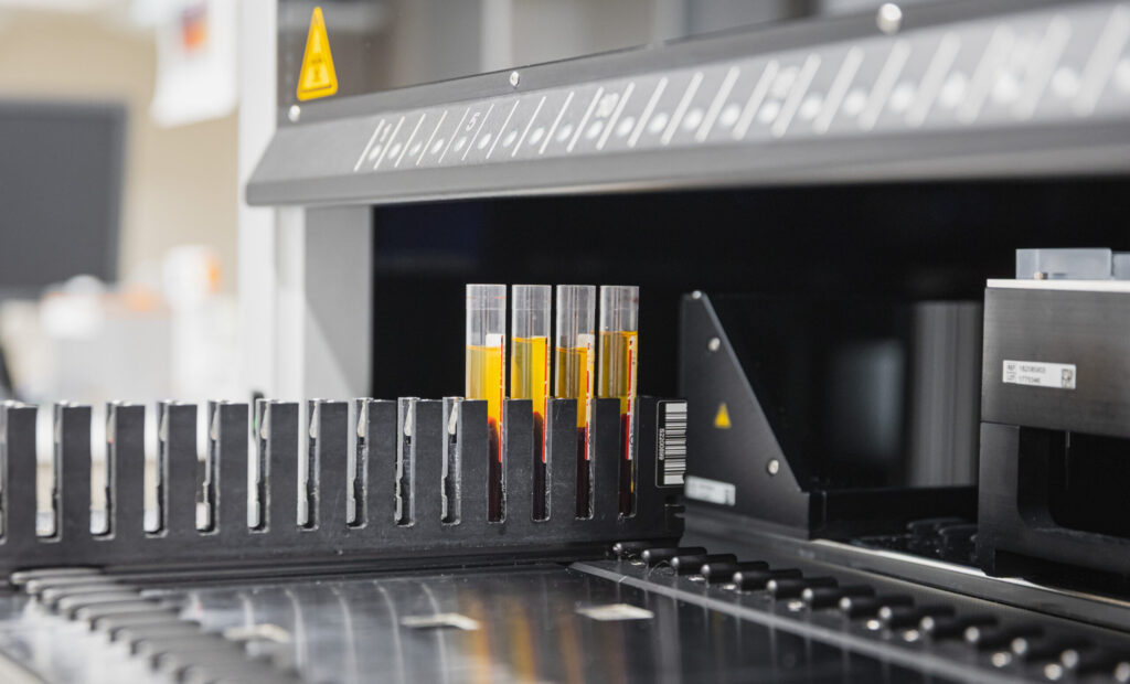 Biopankkinäytteitä menossa nesteenkäsittelijärobottiin sisään.